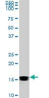 Anti-NME2 Mouse Monoclonal Antibody [clone: 1D3]