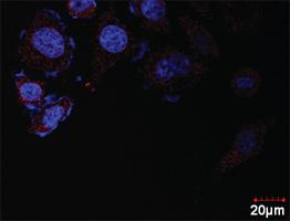 Anti-E2F2 Antibody Pair