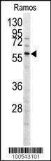 Anti-Menin Rabbit Polyclonal Antibody (HRP (Horseradish Peroxidase))