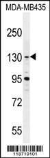 Anti-GLTSCR1 Rabbit Polyclonal Antibody (Biotin)