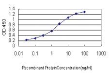 Anti-GHR Mouse Monoclonal Antibody [clone: 3A12]