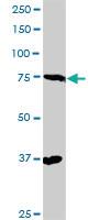 Anti-RAD17 Rabbit Polyclonal Antibody