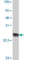 Anti-BMP1 Mouse Polyclonal Antibody