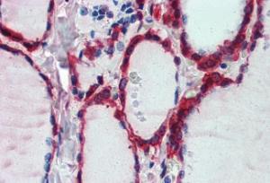 Anti-PRDX1 Antibody (A83660) (2.5 µg/ml) staining of paraffin embedded Human Thyroid Gland. Steamed antigen retrieval with citrate buffer pH 6, AP-staining