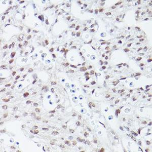 Immunohistochemistry analysis of paraffin-embedded mouse fetal Heart using Anti-Islet 1 Antibody [ARC0511] (A309185) at a dilution of 1:100 (40X lens). Perform high pressure antigen retrieval with 10 mM citrate buffer pH 6.0 before commencing with IHC staining protocol