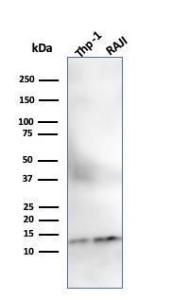 Anti-beta 2 Microglobulin antibody