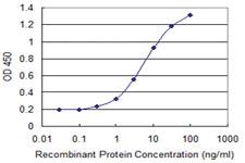 Anti-CENPJ Mouse Monoclonal Antibody [clone: 1A5]