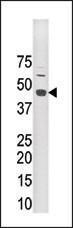 Anti-STE20-related Kinase Adapter Protein alpha Rabbit Polyclonal Antibody (PE (Phycoerythrin))