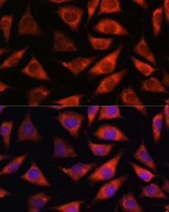 Immunofluorescence analysis of L929 cells using Anti-TMX2 Antibody (A93341) at a dilution of 1:100. DAPI was used to stain the cell nuclei (blue).