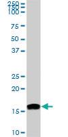 Anti-NME2 Mouse Monoclonal Antibody [clone: 1D3]