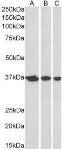 Anti-APEX1 Antibody (A83661) (03 µg/ml) staining of A431 (A), HeLa (B) and MCF7 (C) nuclear lysates (35 µg protein in RIPA buffer) Primary incubation was 1 hour Detected by chemiluminescence