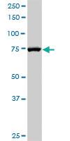 Anti-RAD17 Rabbit Polyclonal Antibody