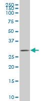 Anti-ZIC4 Mouse Monoclonal Antibody [clone: 3H6]