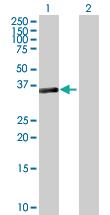 Anti-SESN3 Mouse Polyclonal Antibody