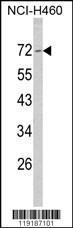 Anti-NF2 Rabbit Polyclonal Antibody