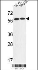 Anti-FANCC Rabbit Polyclonal Antibody (FITC (Fluorescein Isothiocyanate))