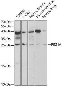 Western blot analysis of extracts of various cell lines, using Anti-REG1A Antibody (A5327)