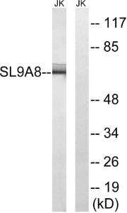 Western blot analysis of lysates from Jurkat cells using Anti-SLC9A8 Antibody. The right hand lane represents a negative control, where the antibody is blocked by the immunising peptide