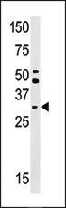 Anti-STUB1 Rabbit Polyclonal Antibody