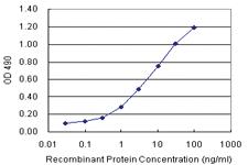 Anti-S100 A9 Antibody Pair