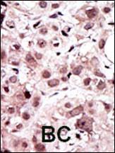 Anti-AXL Rabbit Polyclonal Antibody (FITC (Fluorescein Isothiocyanate))