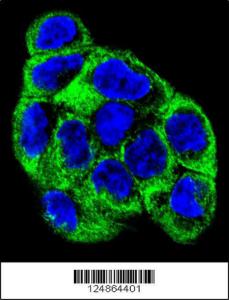 Anti-ATP6V1B1 Rabbit Polyclonal Antibody (APC (Allophycocyanin))