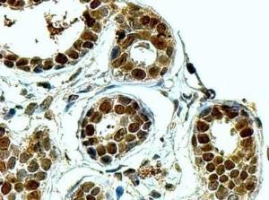 Anti-APEX1 Antibody (A83661) (4 µg/ml) staining of paraffin embedded Human Breast Steamed antigen retrieval with Tris/EDTA buffer pH 9, HRP-staining