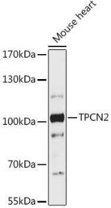 Western blot analysis of extracts of Mouse heart, using Anti-TPC2 Antibody (A93343) at 1:1,000 dilution. The secondary antibody was Goat Anti-Rabbit IgG H&L Antibody (HRP) at 1:10,000 dilution.