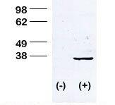 Anti-STUB1 Rabbit Polyclonal Antibody