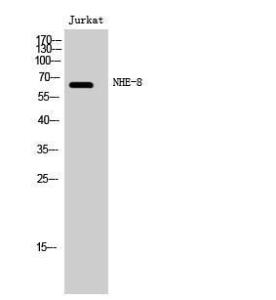 Western blot analysis of Jurkat cells using Anti-SLC9A8 Antibody