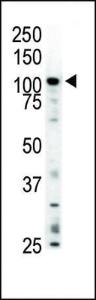 Anti-MERTK Rabbit Polyclonal Antibody (AP (Alkaline Phosphatase))