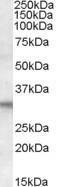 Anti-FHL2 Antibody (A83662) (1µg/ml) staining of Human Heart lysate (35µg protein in RIPA buffer). Primary incubation was 1 hour. Detected by chemiluminescence.