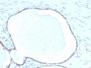 Immunohistochemical analysis of formalin-fixed, paraffin-embedded human prostate tissue using Anti-Cytokeratin 14 Antibody [KRT14/4132]