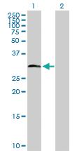 Anti-HDAC7 Rabbit Polyclonal Antibody