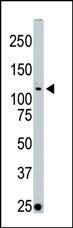 Anti-STK10 Rabbit Polyclonal Antibody (AP (Alkaline Phosphatase))