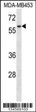 Anti-FANCG Rabbit Polyclonal Antibody (AP (Alkaline Phosphatase))