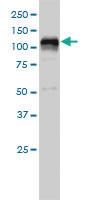 Anti-HDAC7 Mouse Monoclonal Antibody [clone: 2B11-1C1]