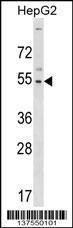 Anti-GLTSCR2 Rabbit Polyclonal Antibody (FITC (Fluorescein Isothiocyanate))