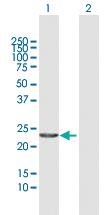 Anti-CENPN Rabbit Polyclonal Antibody