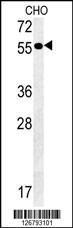 Anti-AMY2A Rabbit Polyclonal Antibody (PE (Phycoerythrin))