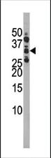 Anti-CDK1 Rabbit Polyclonal Antibody