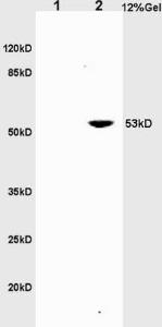 Anti-TNFRSF8 Rabbit Polyclonal Antibody