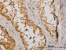 Anti-NME2 Mouse Monoclonal Antibody [clone: 1D3]