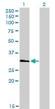 Anti-HDAC7 Mouse Monoclonal Antibody [clone: 2B11-1C1]