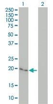 Anti-CYGB Mouse Monoclonal Antibody [clone: 1A1]