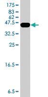 Anti-HMGA2 Mouse Polyclonal Antibody