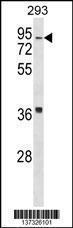 Anti-HIRIP3 Rabbit Polyclonal Antibody (AP (Alkaline Phosphatase))