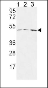 Anti-HAPLN1 Rabbit Polyclonal Antibody (AP (Alkaline Phosphatase))