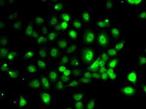 Immunofluorescence analysis of MCF7 cells using Anti-PPP2R1B Antibody (A309187)