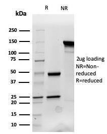 SDS-PAGE analysis of Anti-Cytokeratin 14 Antibody [KRT14/4132] under non-reduced and reduced conditions; showing intact IgG and intact heavy and light chains, respectively. SDS-PAGE analysis confirms the integrity and purity of the Antibody